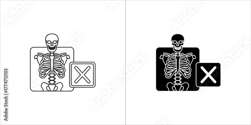 Xray icon set, medical examination vector