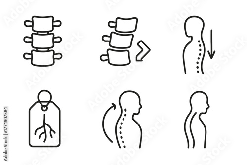 Chiropractic Icon Set. Line style icons of chiropractic care: vertebral subluxation, shifted vertebra icon, misalignment arrow,