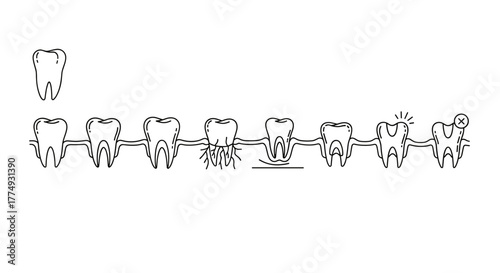 Minimalistic thin outline illustration of a row of teeth, depicting stages of dental health and decay, with one tooth isolated above, suitable for web, graphic design, apps, banners, social networks