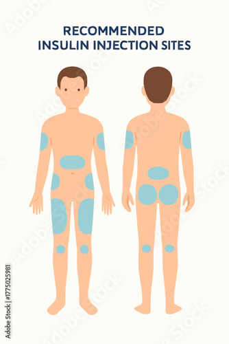 Flat vector diagram showing recommended insulin injection sites on human body