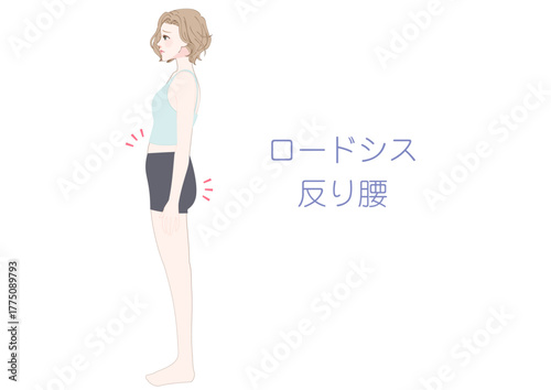 反り腰ロードシスの女性横向きイラスト