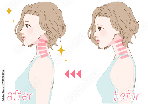 ストレートネックを整える女性の横顔ビフォーアフター