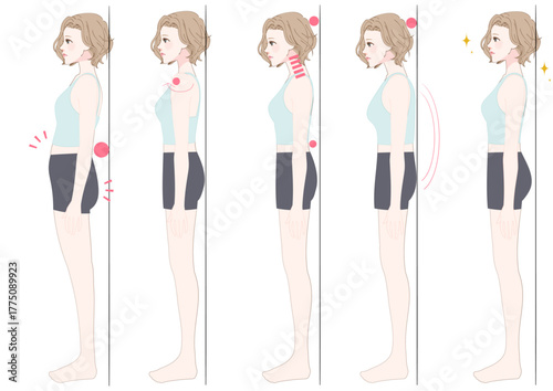 姿勢タイプ別チェック 女性の横向き比較セット