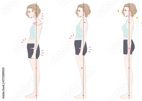 姿勢アライメントチェック女性横向き三パターン比較