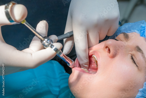 Dentist administers local anesthetic injection into patient gums. Woman wearing blue surgical cap with mouth open during preparation for procedure