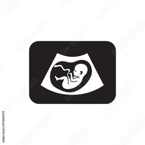Sonogram icon. Ultrasound image of a fetus in the womb. Flat vector isolated.
