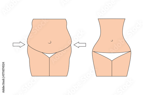 Curvy Body Silhouette Weight Loss Fitness Wellness Concept