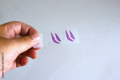 hand holding a glass microscope slide containing a purple-stained tissue sample on a light background