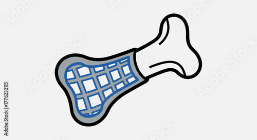 3D Printed Bone Implant for Advanced Orthopedic Care Icon 