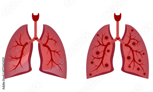 lung with bacteria vector illustration isolated on white background.