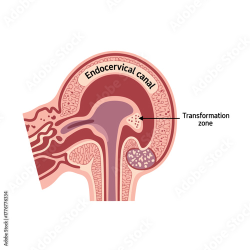 Detailed diagram illustrating the endocervical canal and transformation zone for medical education and research