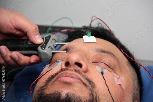 Fotografie Electromyography EMG and facial nerve conduction velocity NCV to assess nerve da