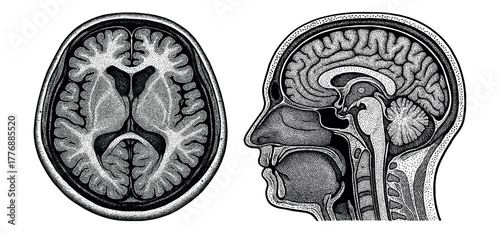 Highly detailed vintage engraving of a human brain and head cross-section. Classic medical illustration showing anatomy and structure, drawn in retro etching style.