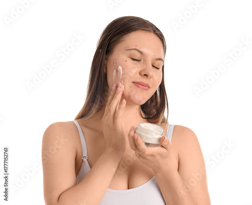 Teenage girl with acne prob...