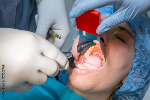 Dental professional uses mouth prop to keep patient mouth open during procedure. Woman wearing surgical cap undergoes dental treatment in hospital