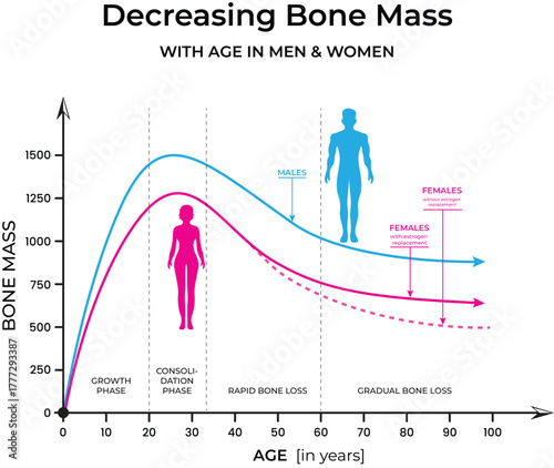 Bone Mass Decline with Age in Men and Women Vector Illustration inforgraphic