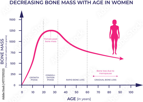 Female Bone Mass Progression and Decline with Age, Highlighting Menopause Impact Vector Illustration