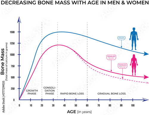 Bone Mass Decline with Age in Men and Women Vector Illustration Infographic