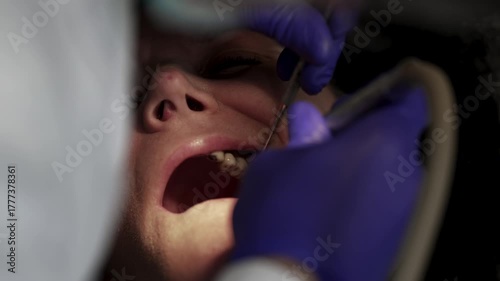 Dentist surgeon is using a variety of instruments to remove a patient old bridge in preparation process for new implant prosthetics teeth