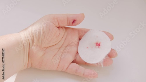 Tiny cut on fingertip, Close up injured thumb with bleeding skin, splinter wound on finger detail, painful hand injury, medical first aid, hygiene awareness, personal care, everyday accident