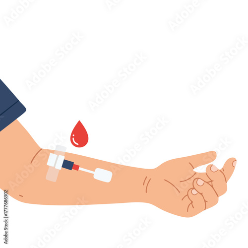 Illustrative depiction of an arm undergoing a medical procedure involving intravenous access blood donation or sample collection