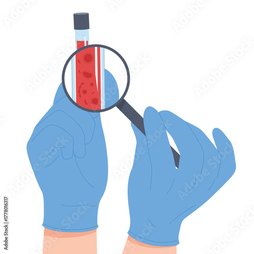 Laboratory blood test for infection. Doctors hands hold magnifying glass and test tube with blood sample to research and find viruses and bacteria in hematology analysis cartoon vector illustration