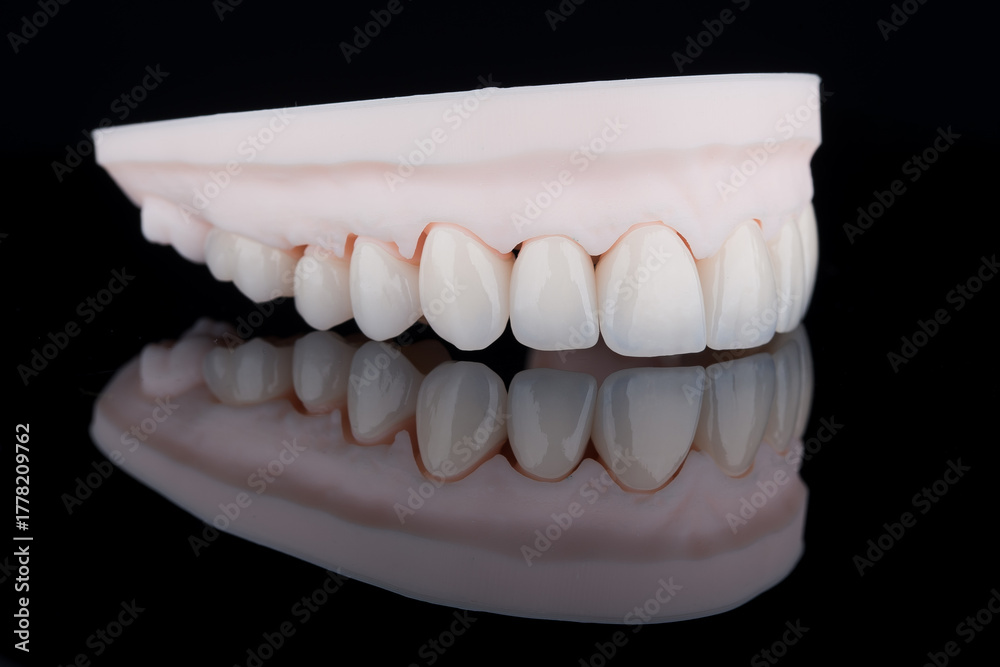 Obraz premium Quality dental zirconium crowns of upper jaw stylized as young teeth on 3D printed model.