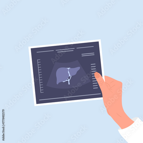 Liver health. Female hand holding liver ultrasound result. Medical diagnosis and treatment for hepatitis, cirrhosis, or hepatic cancer. Cartoon vector illustration.