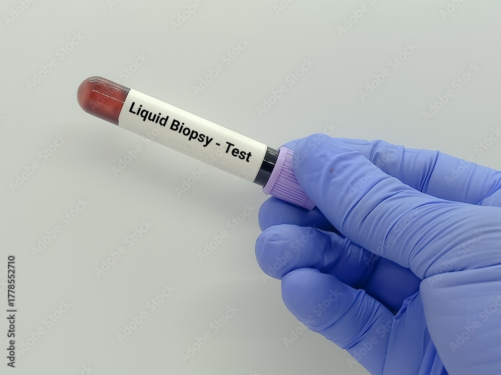 Obraz premium Doctor holds blood sample for Liquid biopsy test to detect cancer cells or DNA fragments.