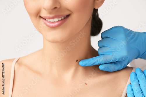 Dermatologist examining mol...