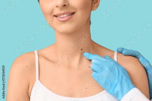 Dermatologist examining mol...
