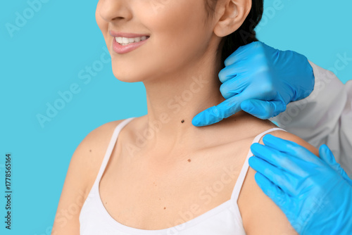 Dermatologist examining mol...