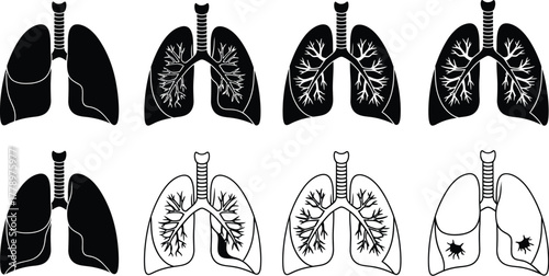 Illustration showing healthy lungs and lungs with disease progression