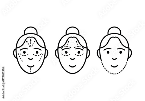 Icons of a female face with surgical markings. Simple facial surgery icons.