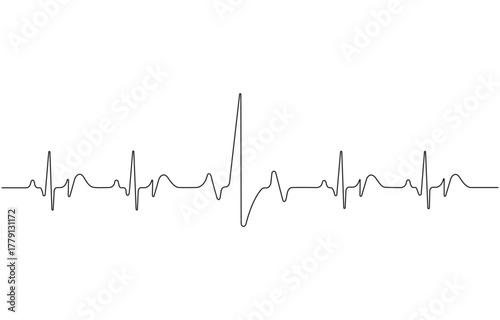 Continuous one line drawing representing a heartbeat, single line pulse rate art vector illustration.