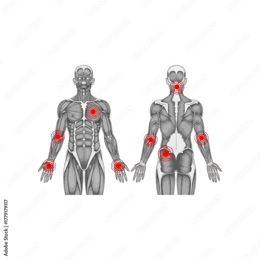 Fototapeta premium Anatomical human muscle pain map illustration, front and back, common joint and body aches