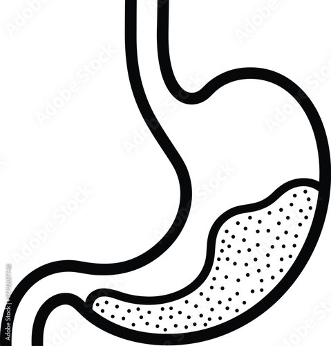 Illustration Of Human Stomach With Dot Pattern Digestive Ailment Icon