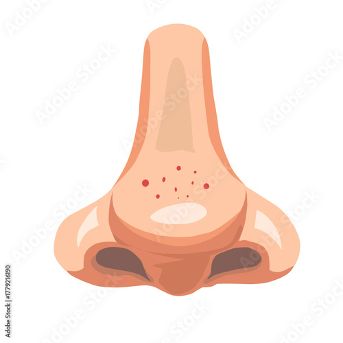 Nose with Blackheads and Clogged Pores Vector