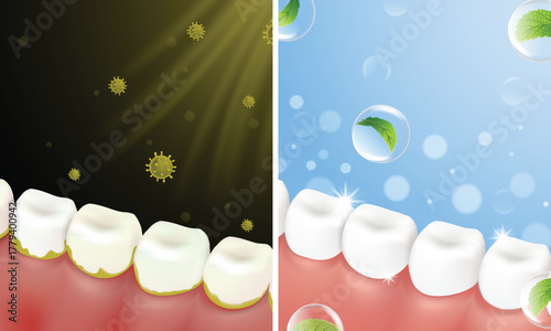 Molar teeth Before and After comparison. 3D vector of plaque removal and fresh breath concept
