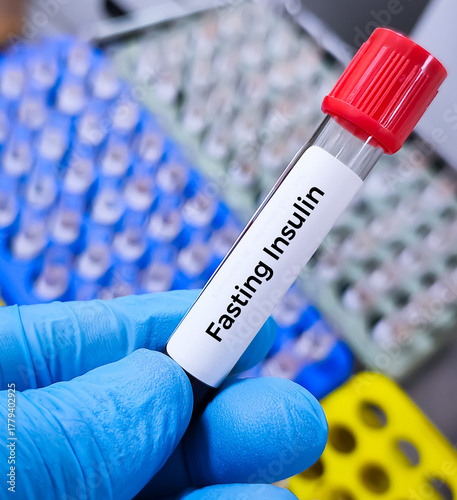 Blood sample for Fasting Insulin test used to detect insulin resistance. OGTT. Glucose Challenge test.