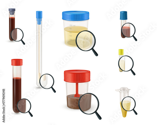 Set of filled containers for laboratory analysis, with a magnifying glass, blood, urine, feces.
