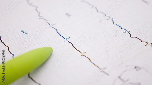 stock market graph on white