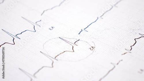 heart on the cardiogram