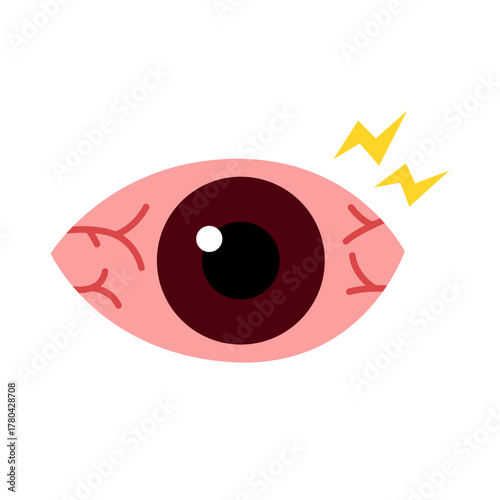 conjunctivitis eyes allergy infection disease