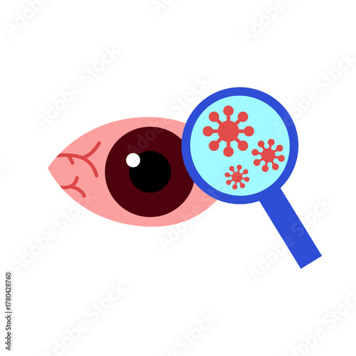conjunctivitis eyes allergy infection disease