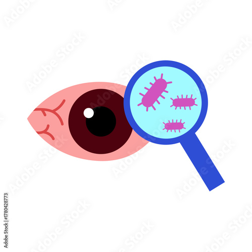 conjunctivitis eyes allergy infection disease