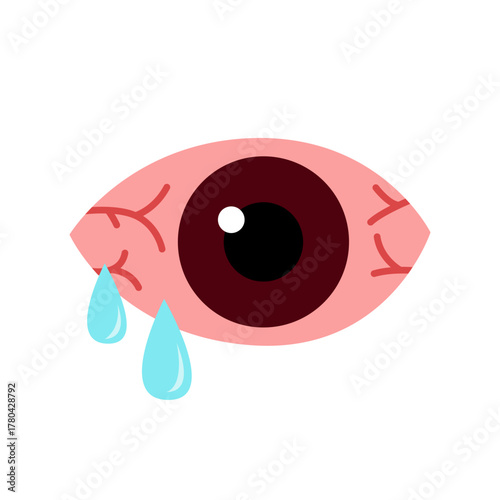 conjunctivitis eyes allergy infection disease