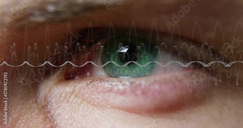 Upon playback starting green eye holding focus, translucent waveform scrolling for medical scan