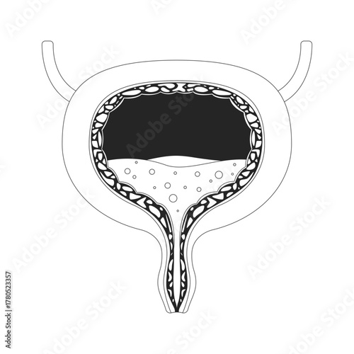 Human urinary bladder cross-section with urine outline illustration. Biology diagram. Medical reference. Internal organ function 2D line object isolated on white. Monochrome vector ink linear image