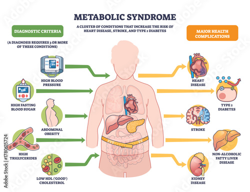 Metabolic syndrome disorders illustrated as clustered risks around a human figure, key icons show high blood pressure, high blood sugar, and abdominal obesity. Outline diagram
